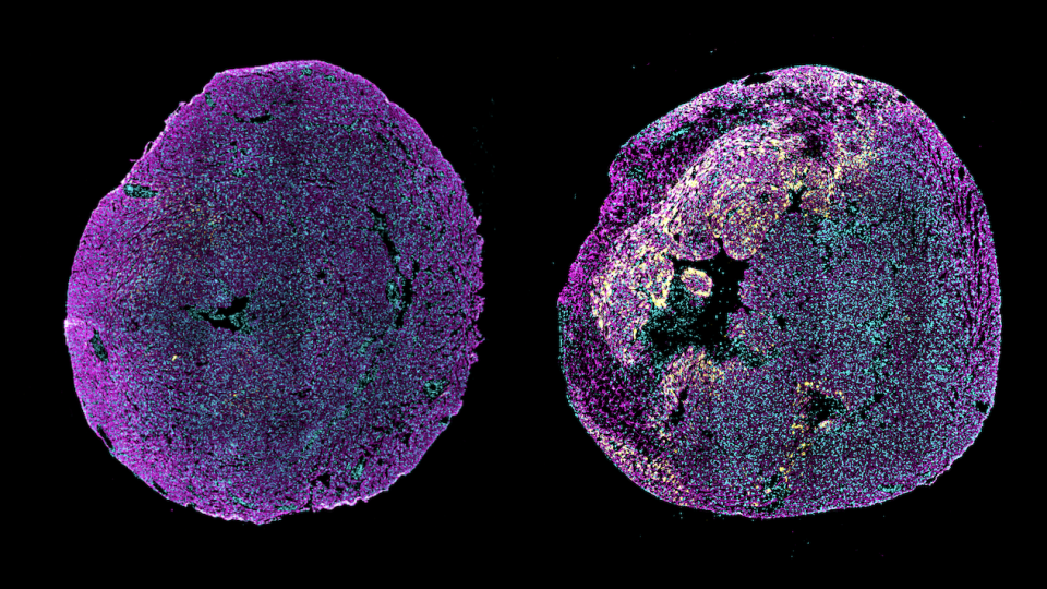 A New RNA Therapy Could Help the Heart Repair Itself